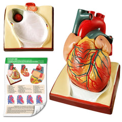 Generies heart model with pericardium base for patient education.