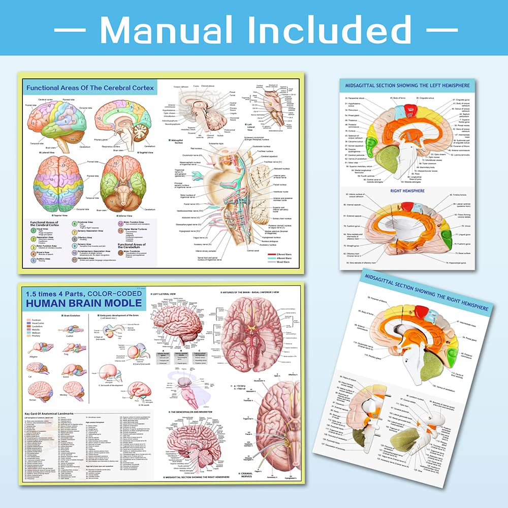 Hadwyn brain model breaks into four parts for easy viewing.