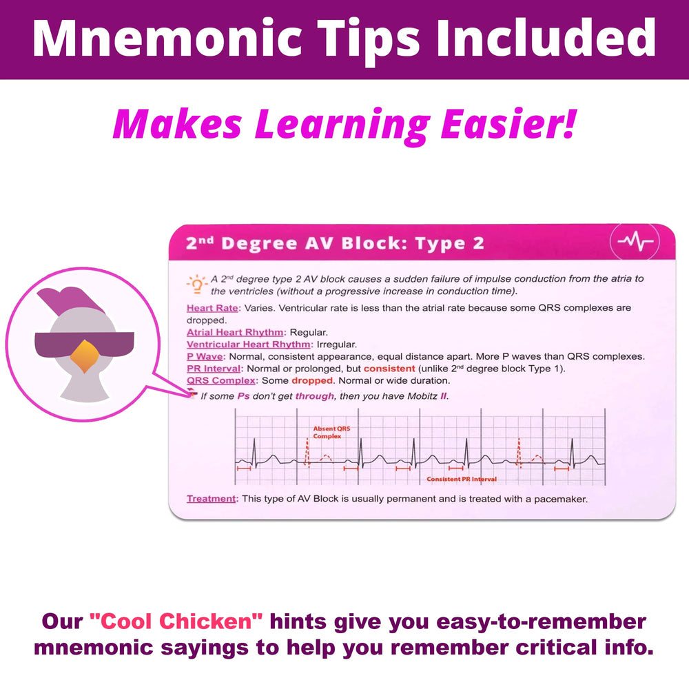 Level Up RN EKG flashcards on a desk for portable study sessions