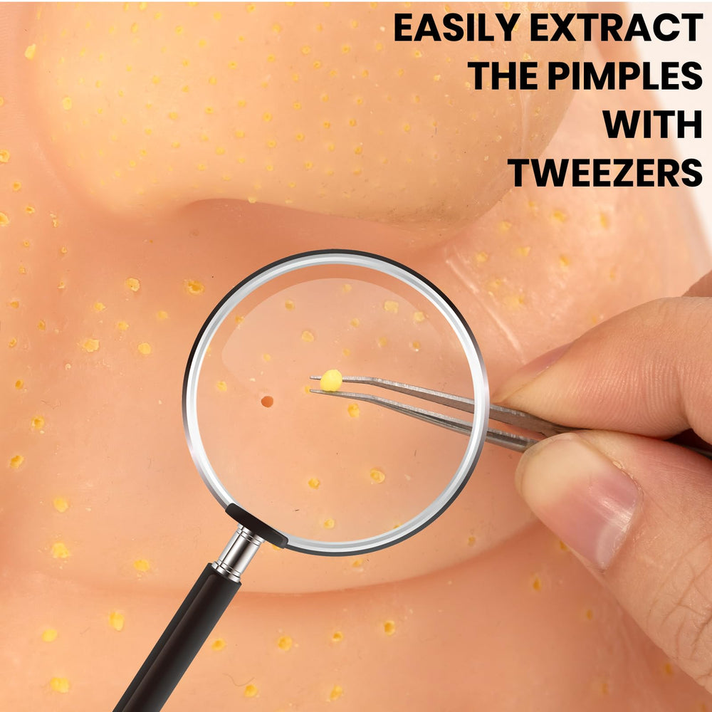 LFEX pimple popping toy close-up showing pus for satisfying tactile feedback.