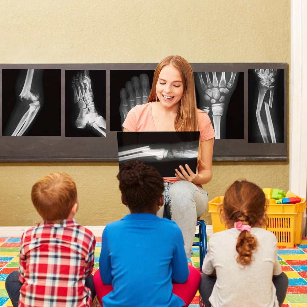 Sayglossy kids learning X-ray set supports safe play and display
