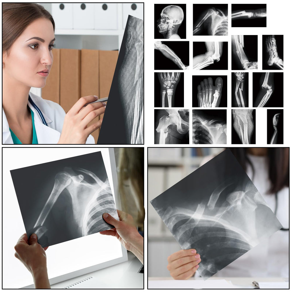 Sayglossy white and black skeleton X-ray visuals for education