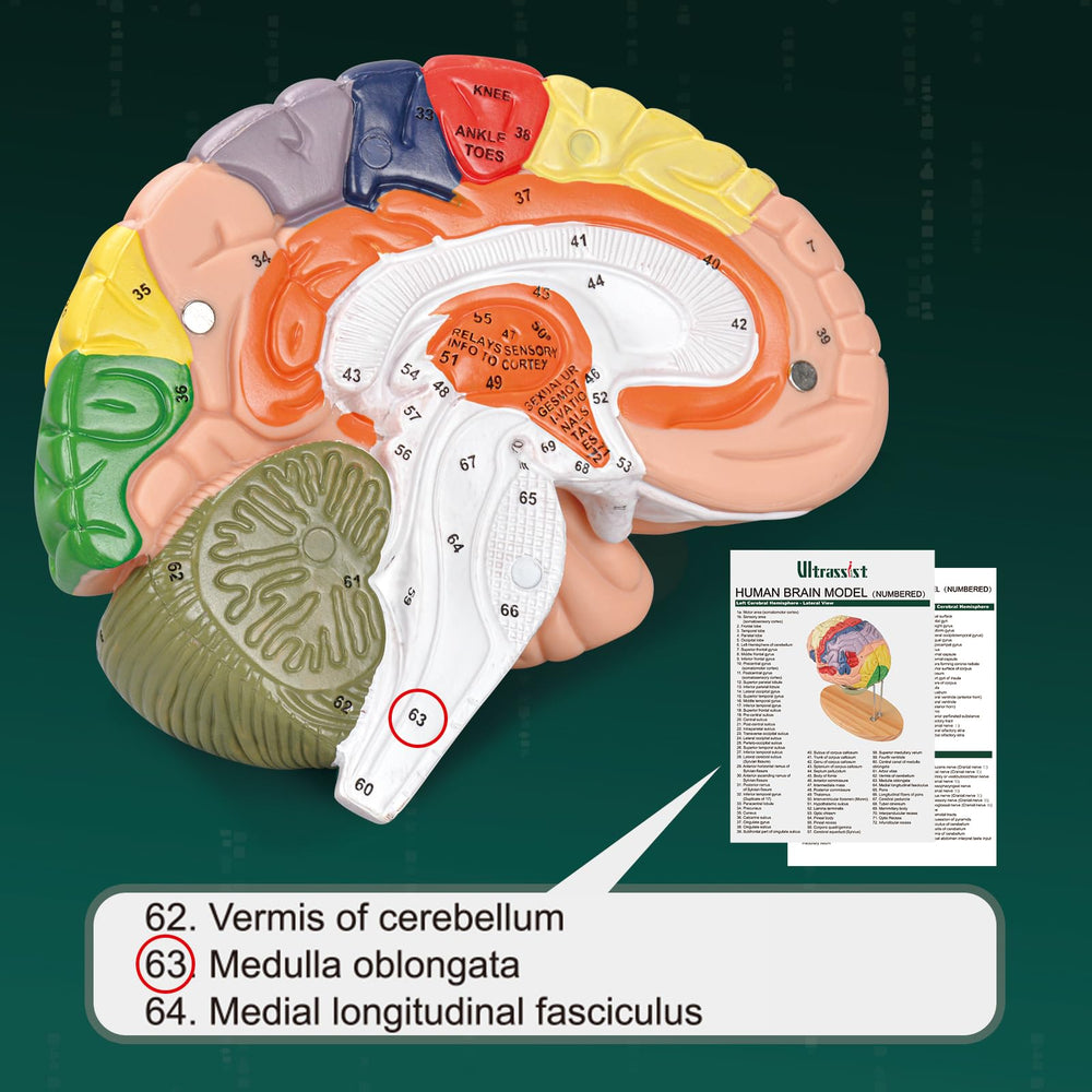 Ultrassist Brain Model laser-engraved labels remain crisp over time