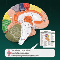 Ultrassist Brain Model laser-engraved labels remain crisp over time