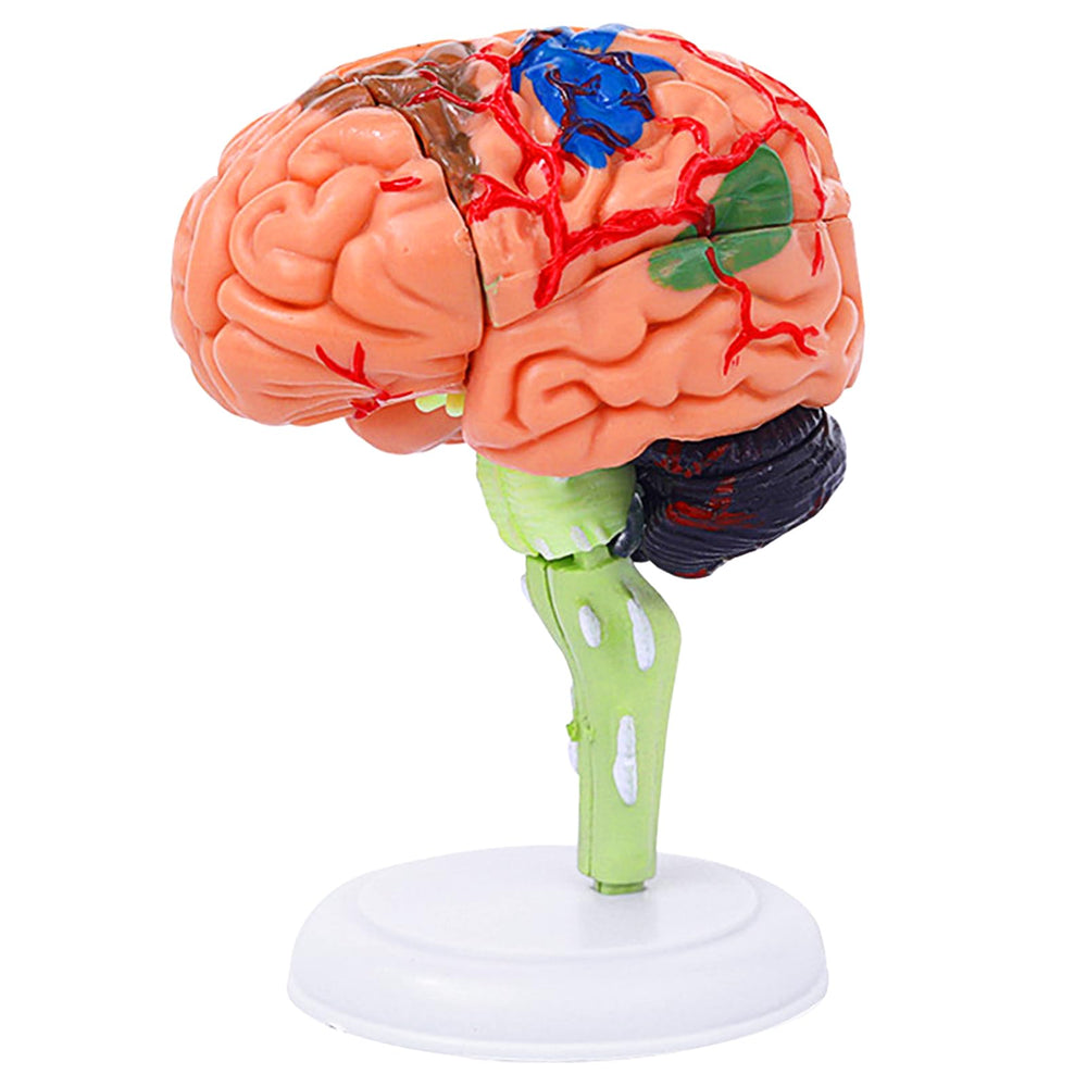 Ceonam small brain model with assembled parts for tactile anatomy study.