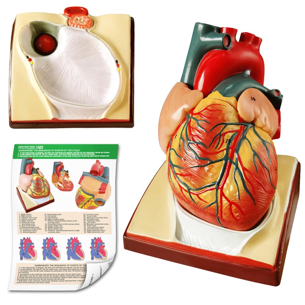 Generies heart model with pericardium base for patient education.