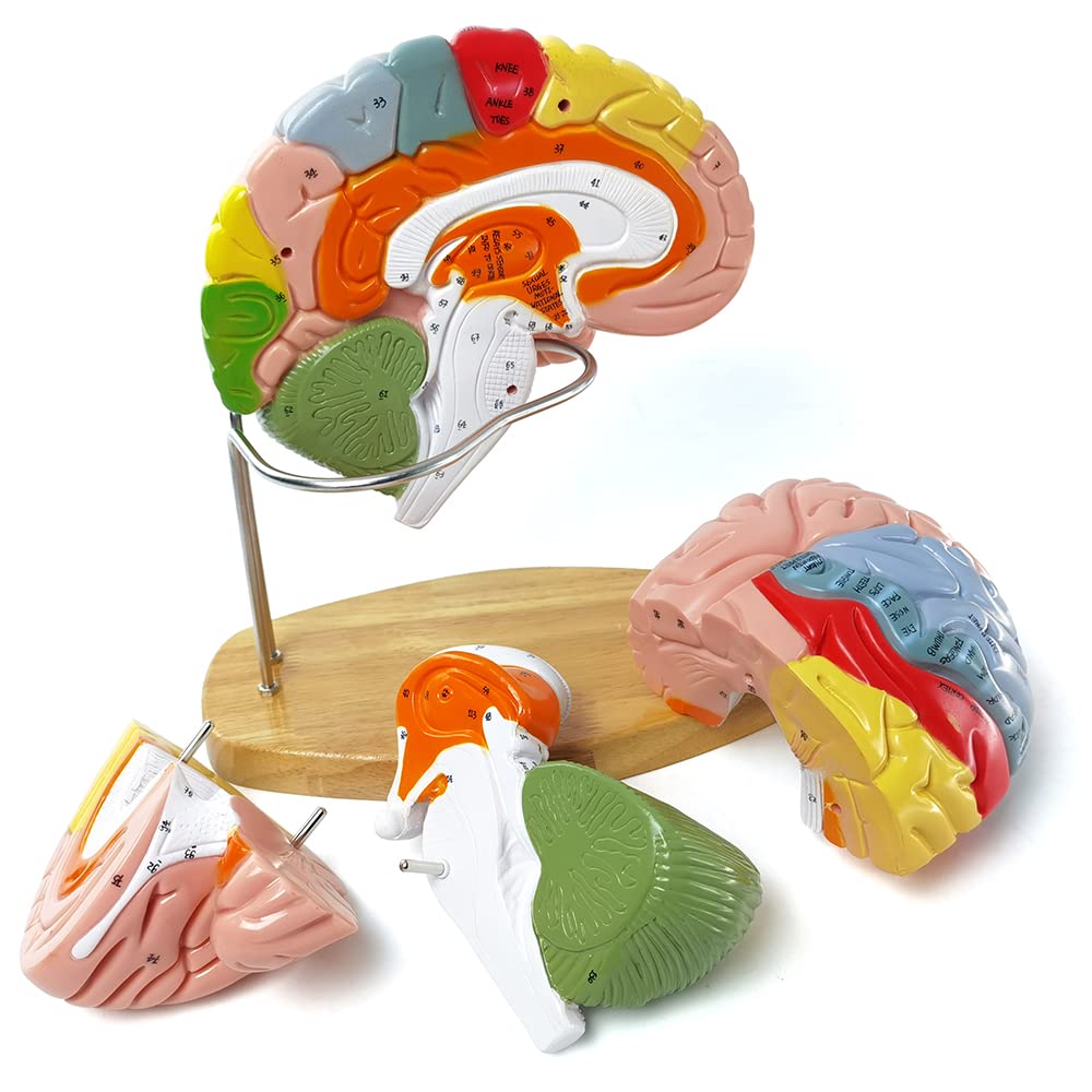 Hadwyn brain model showing limbic system color coding for central identification.