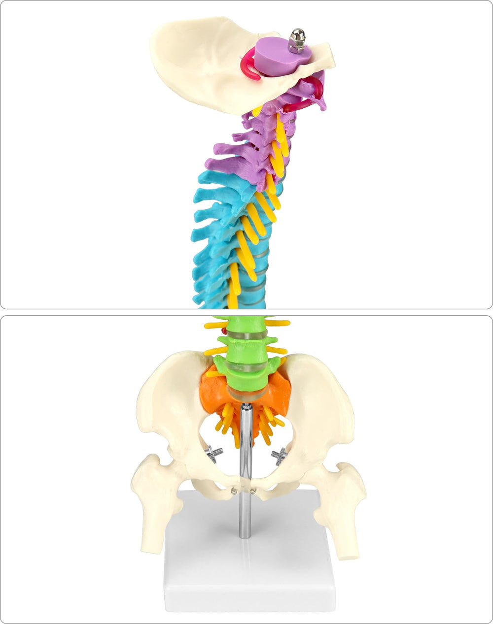 QWORK spine model demonstrates vertebral deformities including scoliosis, lordosis, kyphosis