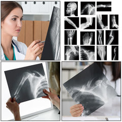 Sayglossy white and black skeleton X-ray visuals for education