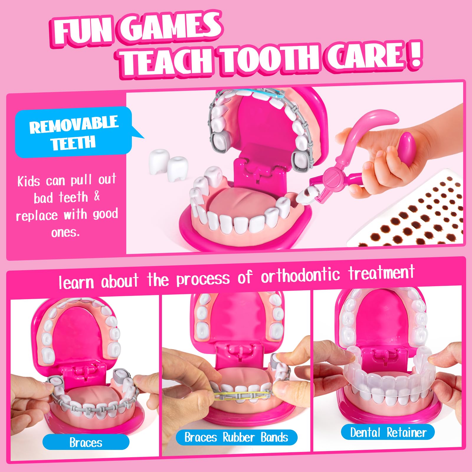 ULOVE ME removable teeth model for practicing extractions and braces.
