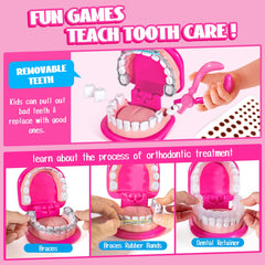 ULOVE ME removable teeth model for practicing extractions and braces.