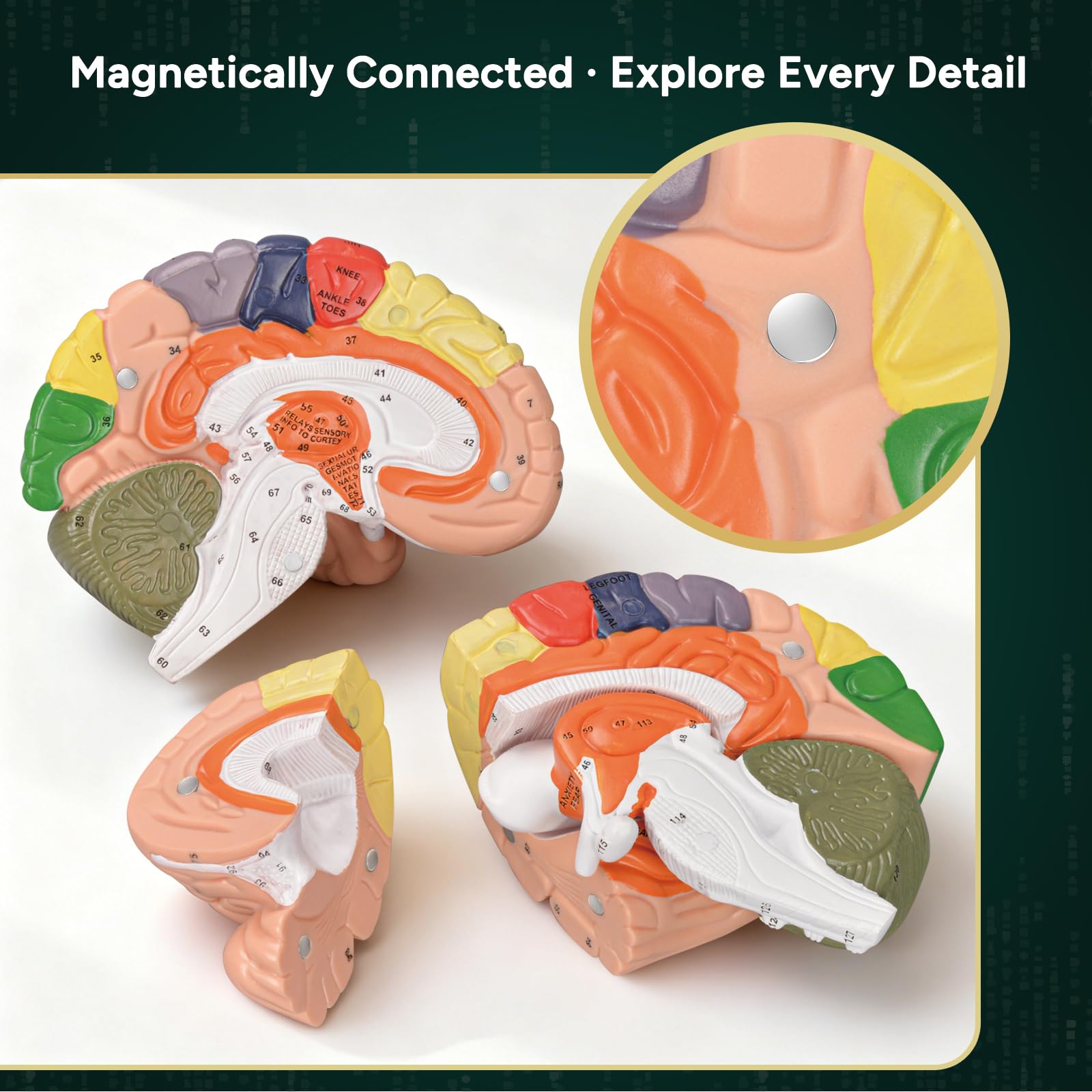 Ultrassist Brain Model nine colored sections differentiate brain structures